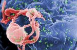 Strašák dnešní doby AIDS neboli HIV pozitivní Strašák dnešní doby AIDS neboli HIV pozitivní